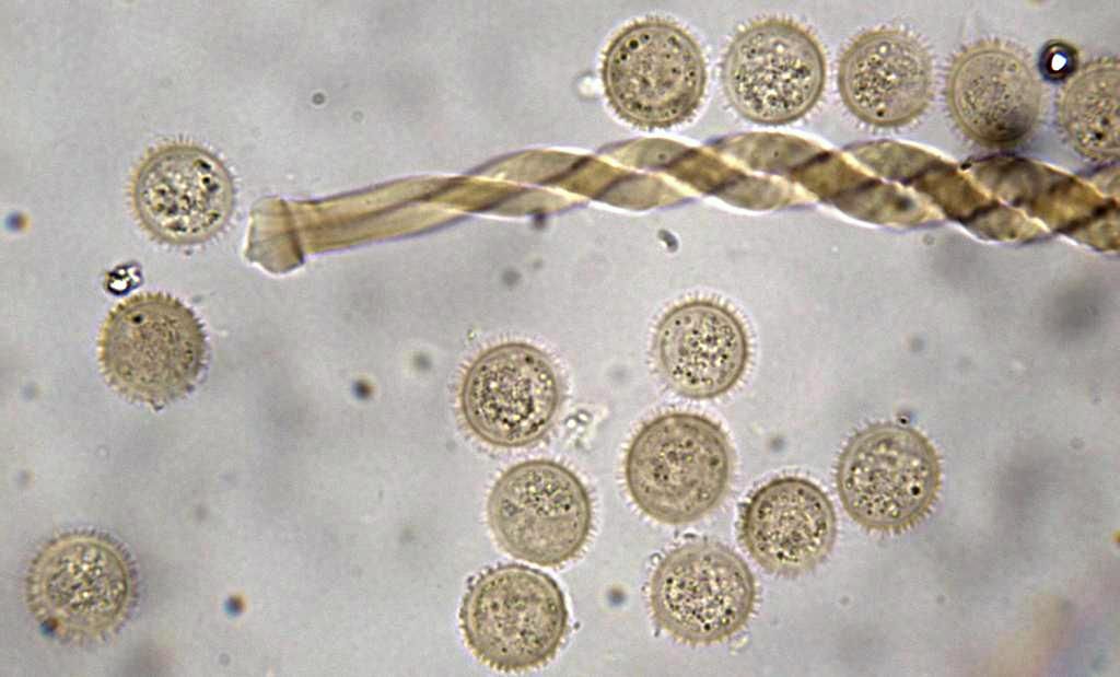 Prototrichia cf metallica